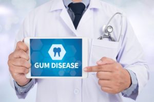 gum disease sign