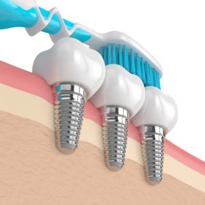 Your dental implants in Pea Ridge can last for decades with the right maintenance. Learn how to ensure your new smile lasts with the right care. 