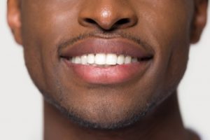 Closeup of beautiful smile thanks to cosmetic dentist